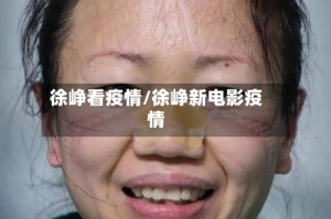 徐峥看疫情/徐峥新电影疫情