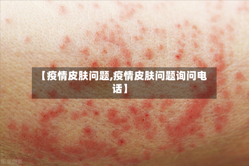 【疫情皮肤问题,疫情皮肤问题询问电话】-第1张图片